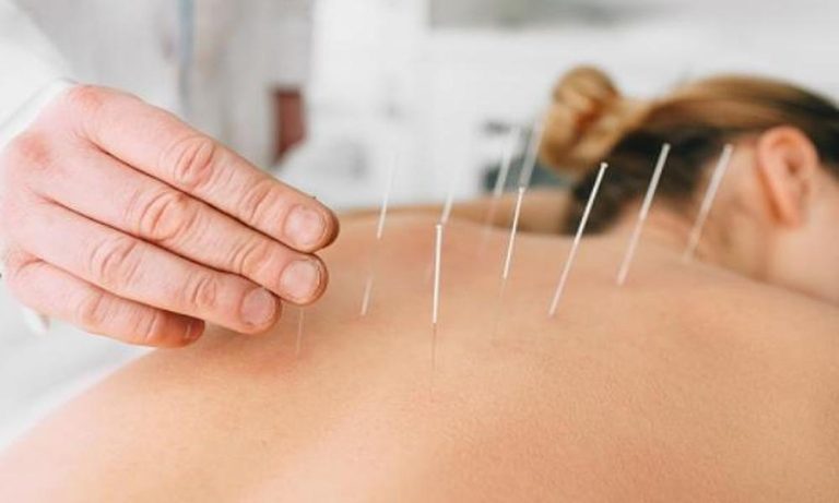 Unlocking the Healing Power of Acupuncture in Auckland: A Beginner’s Guide Unlocking the Healing Power of Acupuncture in Auckland A Beginner's Guide