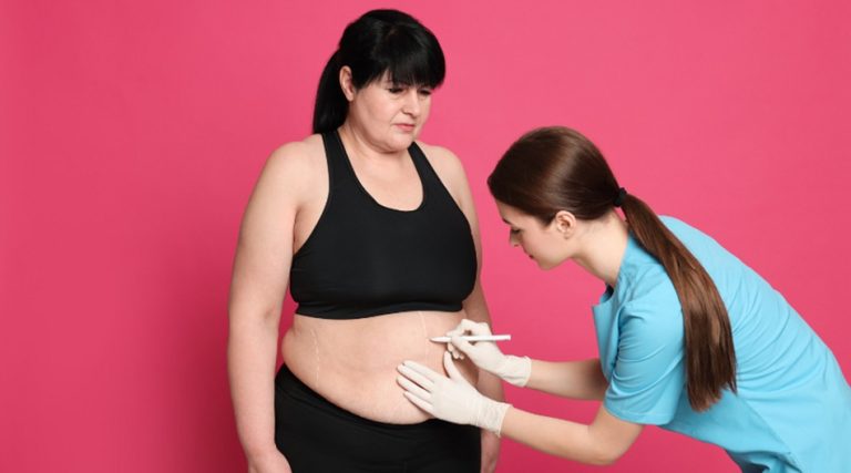 After Bariatric Surgery