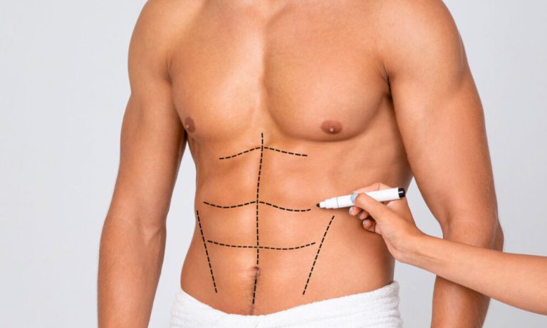Liposuction Surgery in Bahrain: A Guide to Safe and Effective Body Contouring Liposuction Surgery
